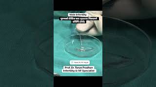 Male Factor Infertility. TESA. #prof.dr.tarunpradhan #InfertilityIVFspecialist