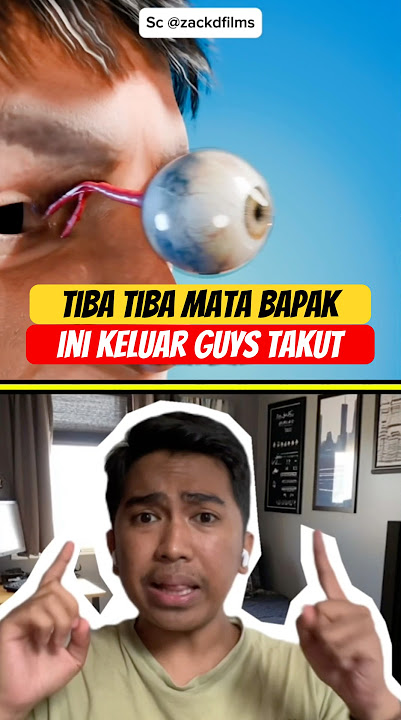 This man's eyes suddenly popped out, guys. How is that possible? #feedshorts #shortsviral #shortv...