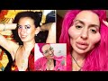 When Plastic Surgery Jobs Go Wrong (Part 2)