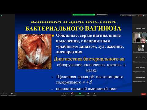 Специфические воспалительные заболевания женских половых органов. Гинекология. Савченко Т.Н.