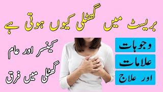 Breast Main Ghutli Ki Wajohat Alamat Or Ilaj - Breast Cancer Reasons