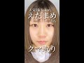 【美容整形】えだまめさん★クマ取りで明るい目元に👀💕#shorts
