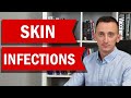 Skin infections red flags never miss these symptoms