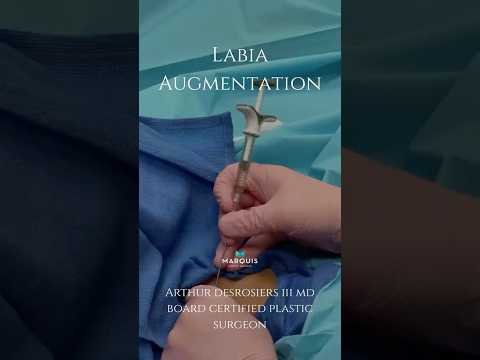 Get Ready With Me Labia Augmentation Labiaaugmentation Labiaplasty Plasticsurgery