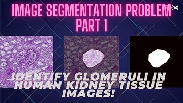 Image Segmentation Problem Using Deep Learning: PART 1