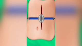 Stomach Surgery Emergency Dr by OXO Games Studio screenshot 5