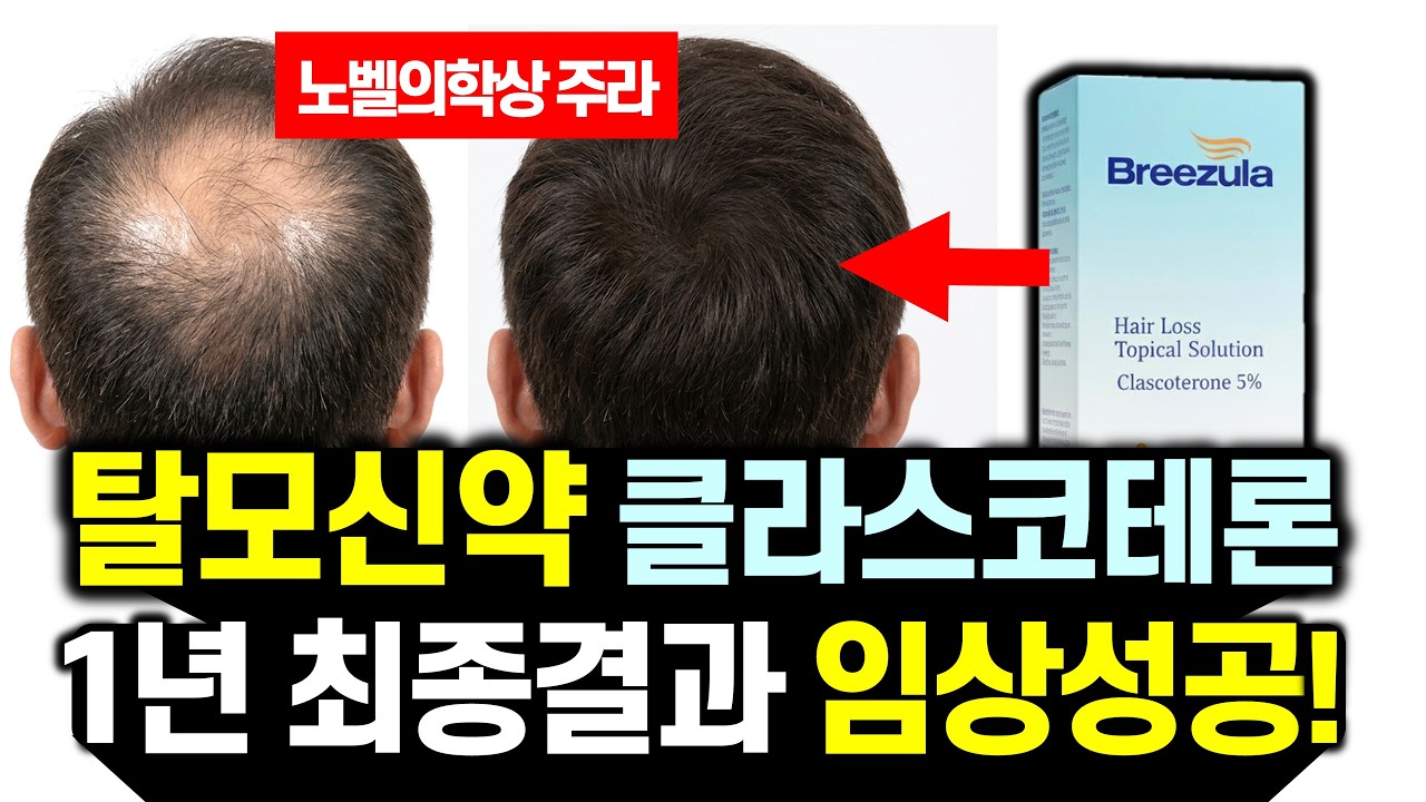 새로운 탈모약 나왔다..  탈모신약 클라스코테론 5% 공식 출시! 탈모인들 필수시청 (feat. 가격, 효과, 부작용)