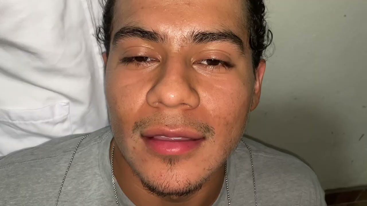 Vargas Vásquez, Katherin Mishel - Examen Clínico del Sistema Estomatognático