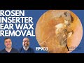 ROSEN INSERTER EAR WAX REMOVAL & OTHERS - EP903
