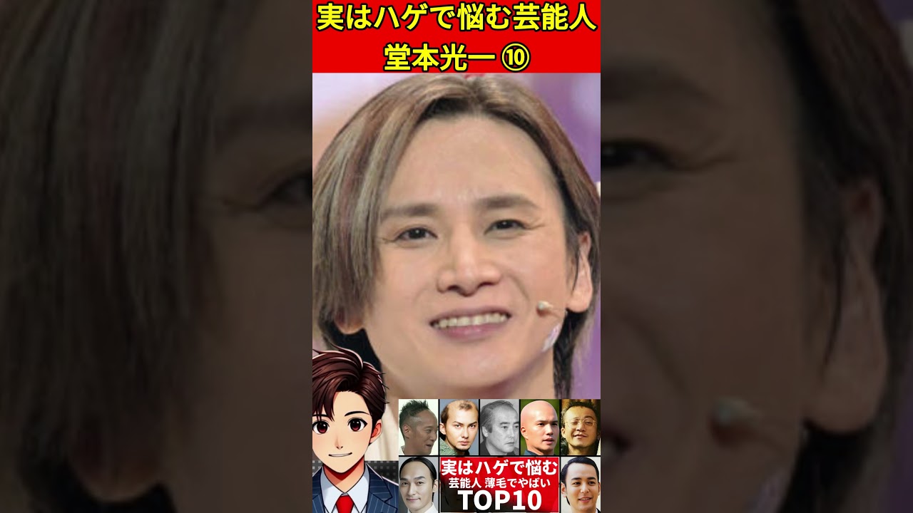 堂本 光一 ハゲ