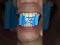 "Super Sour" Nobel Super Soda Candy ASMR #shorts #asmr