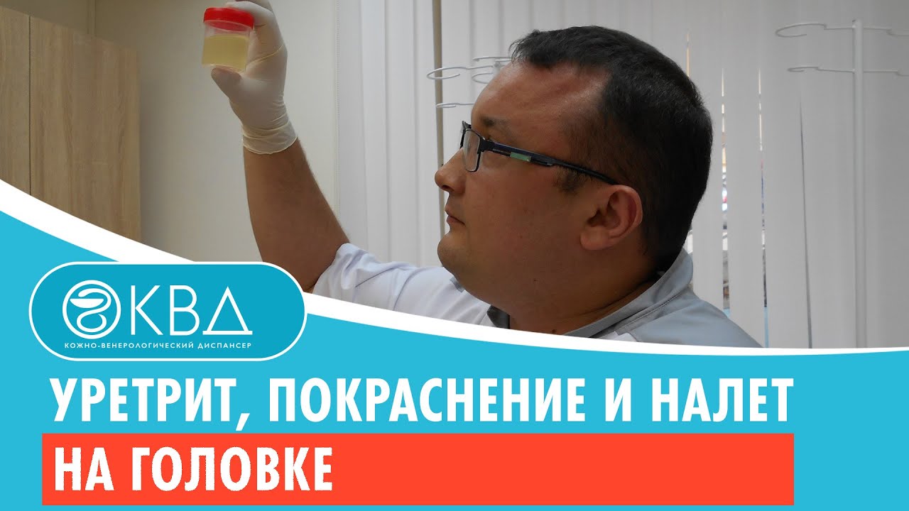👦 Уретрит, покраснение и налет на головке. Клинический случай №310