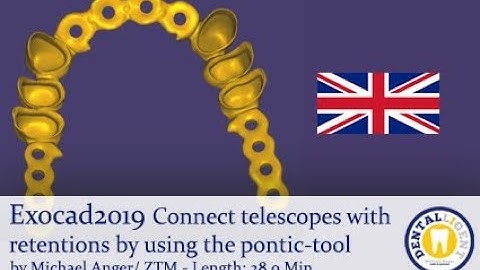 Exocad2019 Tutorial in english:  Connect telescopes with retentions by using the pontic-tool