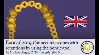 Exocad2019 Tutorial in english:  Connect telescopes with retentions by using the pontic-tool