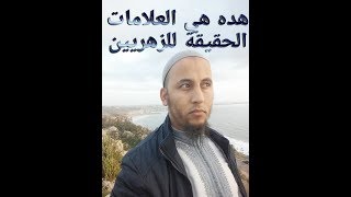 هده هي العلامات الحقيقية للزهريين