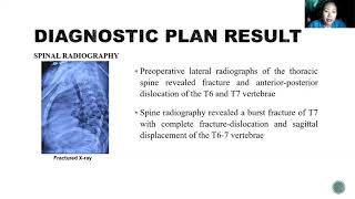 Severe fracture-dislocation of the thoracic spine without any neurological deficit