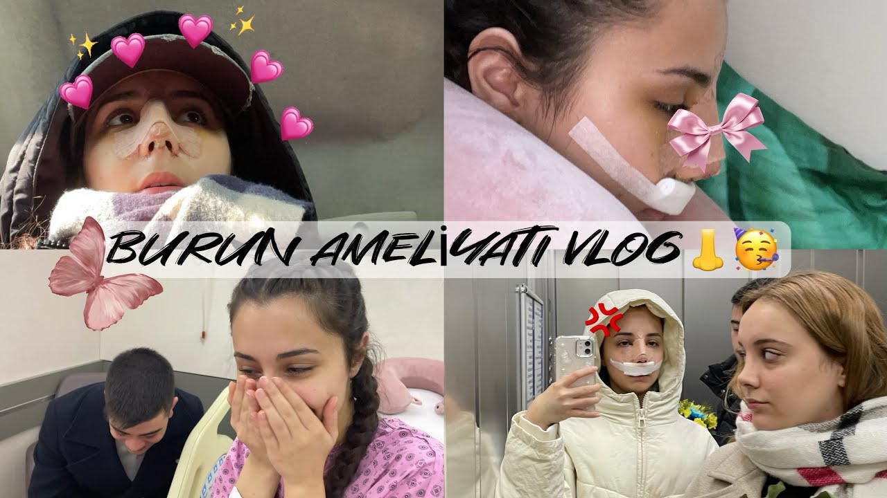 BURUN AMELİYATI OLDUM!! | 10 Günlük Burun Ameliyatı VLOG (Deviasyon-Rinoplasti)