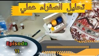 الحلقه (١١) تحليل الصفراء عملي