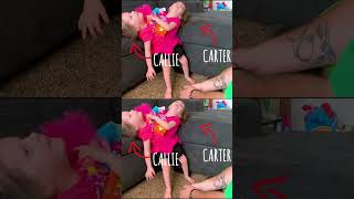 Conjoined Twins Learn To Walk #Borndifferent #Conjoinedtwins #Ytshorts #Sisters #Family #Shorts