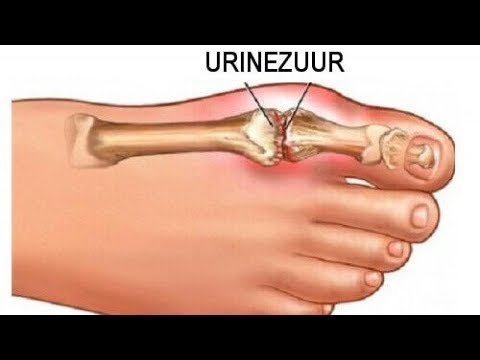 Video: Urinezuur