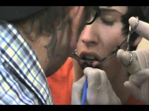 Tongue Splitting- Extreme Body Modification