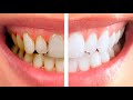 Профессиональная чистка зубов Air Flow в стоматологии Диалог