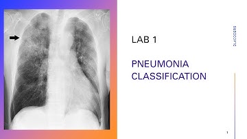 Lab 1: Pneumonia Image Classification & Transfer Learning | Deep Learning for Coders