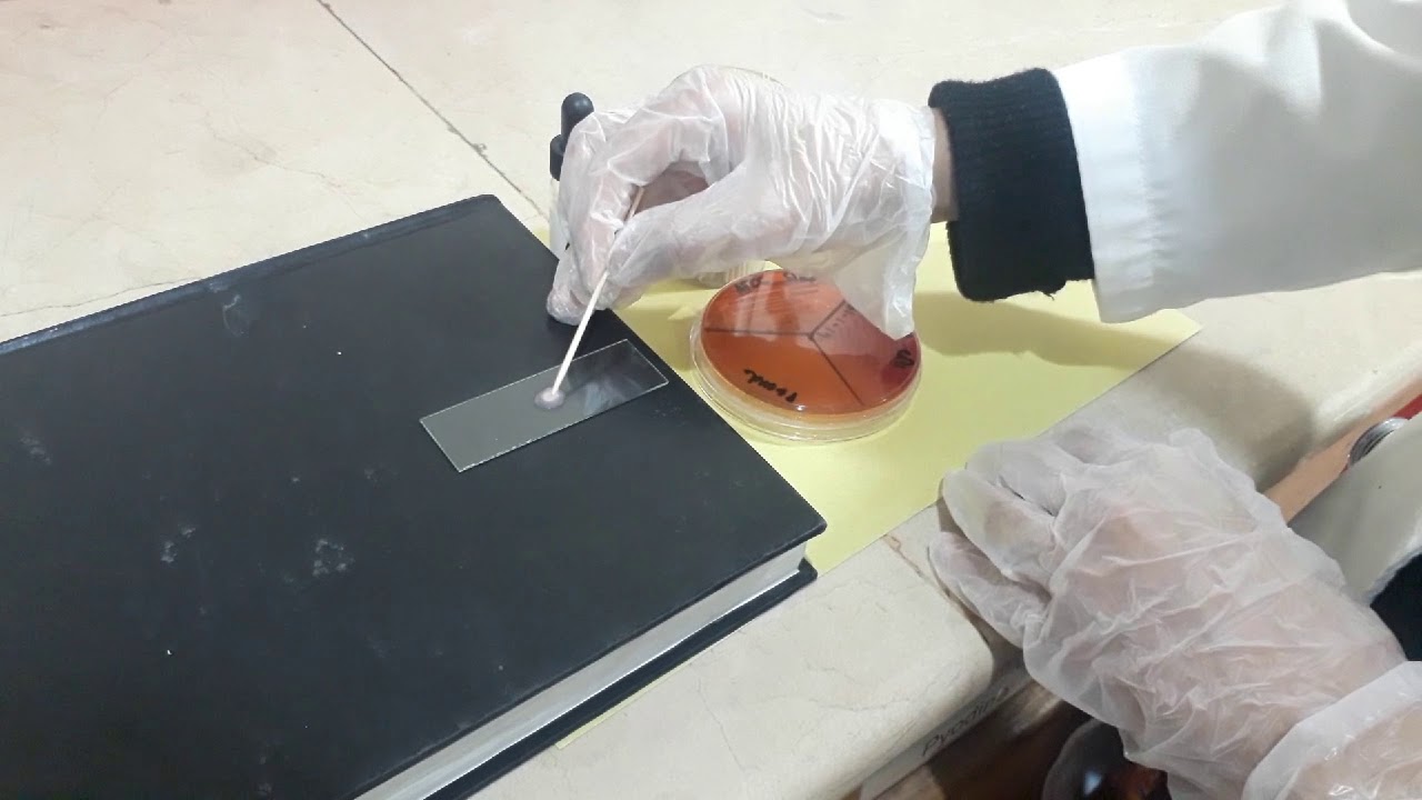 Classification of Gram positive cocci