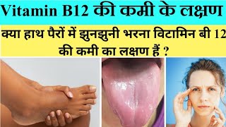 Deficiency of Vitamin B-12 symptoms and treatment/Vitamin B-12 ki kami se Kaya hota hai By DR. S.k