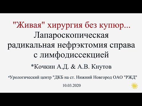 Live Lap nephrectomy RPLND/Лапароскопическая нефрэктомия/Лимфаденэктомия/Живая хирургия