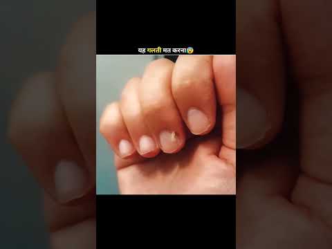 #nails #waitthefact #amazingfacts #thefactartist #factsinhindi #experiment #interestingfacts