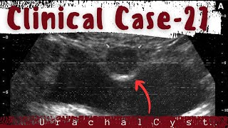 Clinical case file-27 ~ @MyClinicalBook