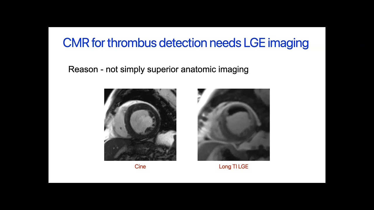 2022 Advanced Cardiac Imaging Lecture Series - May 21 - YouTube