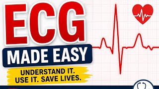How to read an ECG 🔥