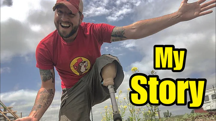 How I Lost My Leg