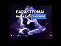 Parasternal Short Axis View - Echocardiography Education