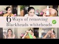 6 ways to remove blackheads and whiteheads at home by physical and chemical method skincare viral