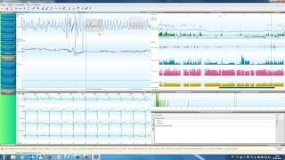 KTR2 obzor
