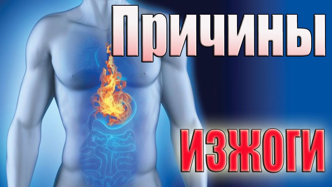 Причины изжоги.Только еда виновата? - YouTube