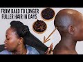 HOW I USE THIS SEEDS TO GROW MY BALDNESS ALOPECIA AND SHEDDING FAST IN DAYS TO HEALTHY & LONGER HAIR