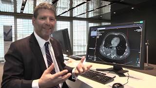 Efficient multi trauma reading with syngo via