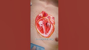 How Defibrillators Work 🤨