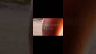 If You Were Bitten By A Snake