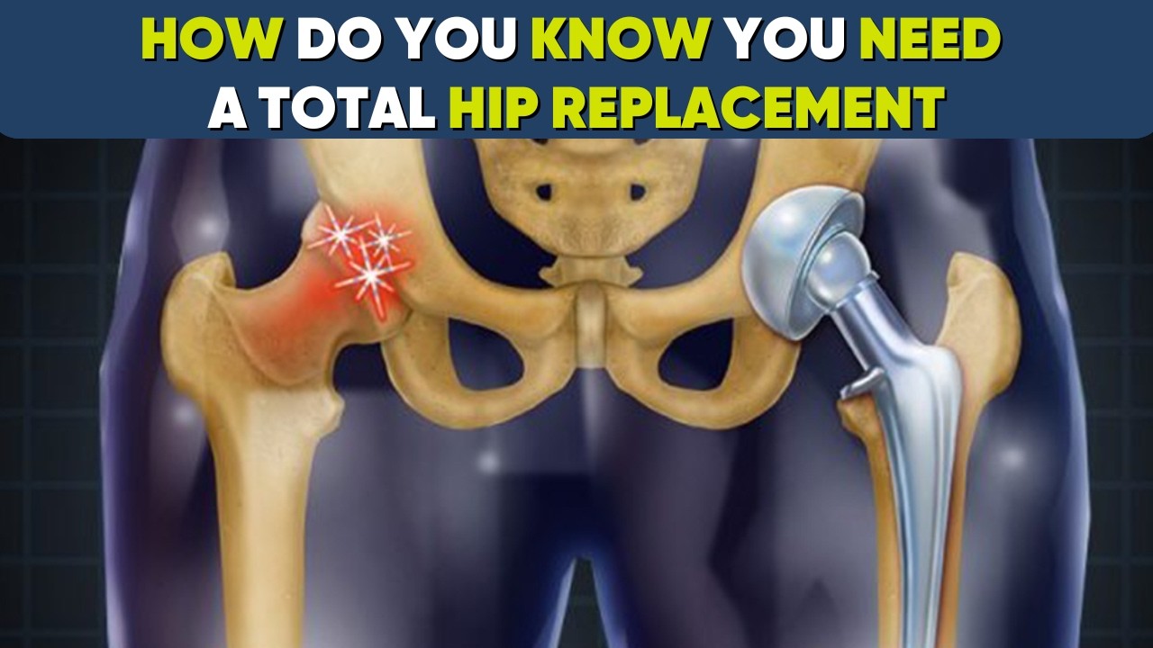 Is Hip Replacement Surgery Right for You? - YouTube