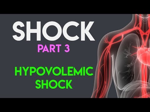 Video: Kejutan Hypovolemic: Punca, Gejala & Diagnosis