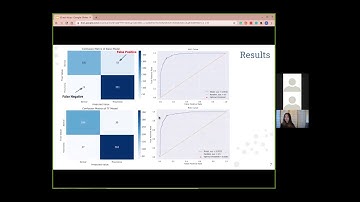 Opacity Detection in Chest X-ray Images with CNNs