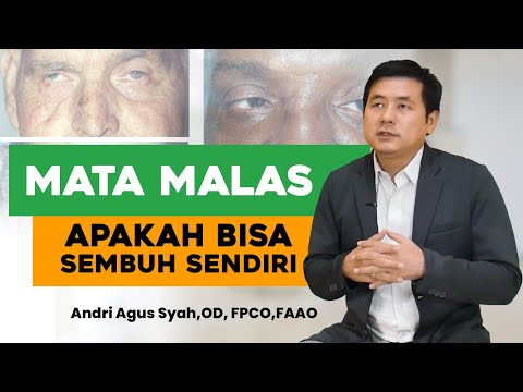 Video: 3 Cara Sederhana Menyembuhkan Mata Malas pada Orang Dewasa Secara Alami