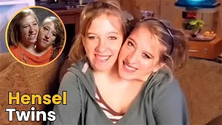 Doctors Share Sad News of Hensel Twins’ Surgery