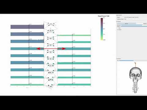 Visualization of Human Spine Biomechanics for Spinal Surgery