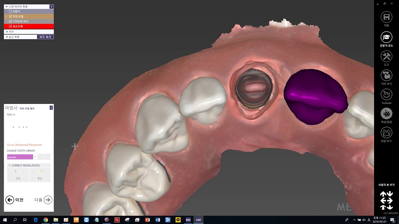Case3 #3 design crown (extra multidie scan, mirroring) - YouTube